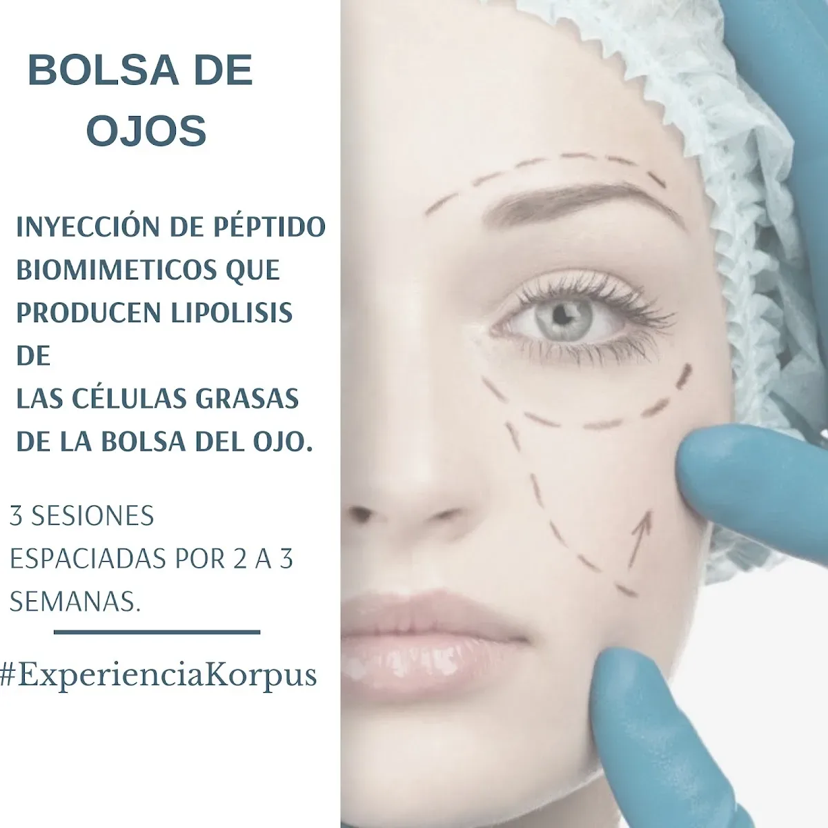 Flyer de Korpus: tratamiento de bolsa de ojos con péptidos biomiméticos